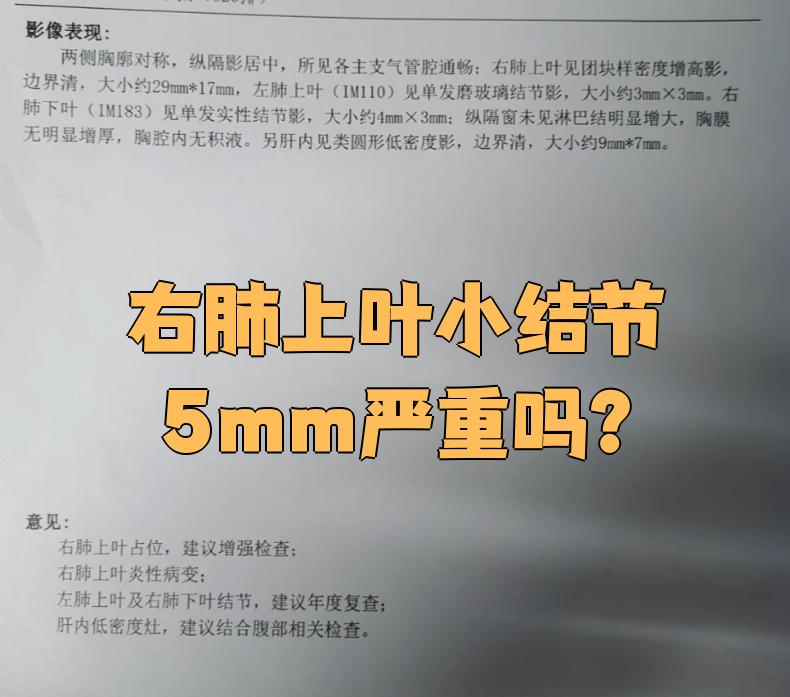 右肺上叶为什么恶性多发结节为什么在线 右肺上叶为什么恶性多发结节为什么在线