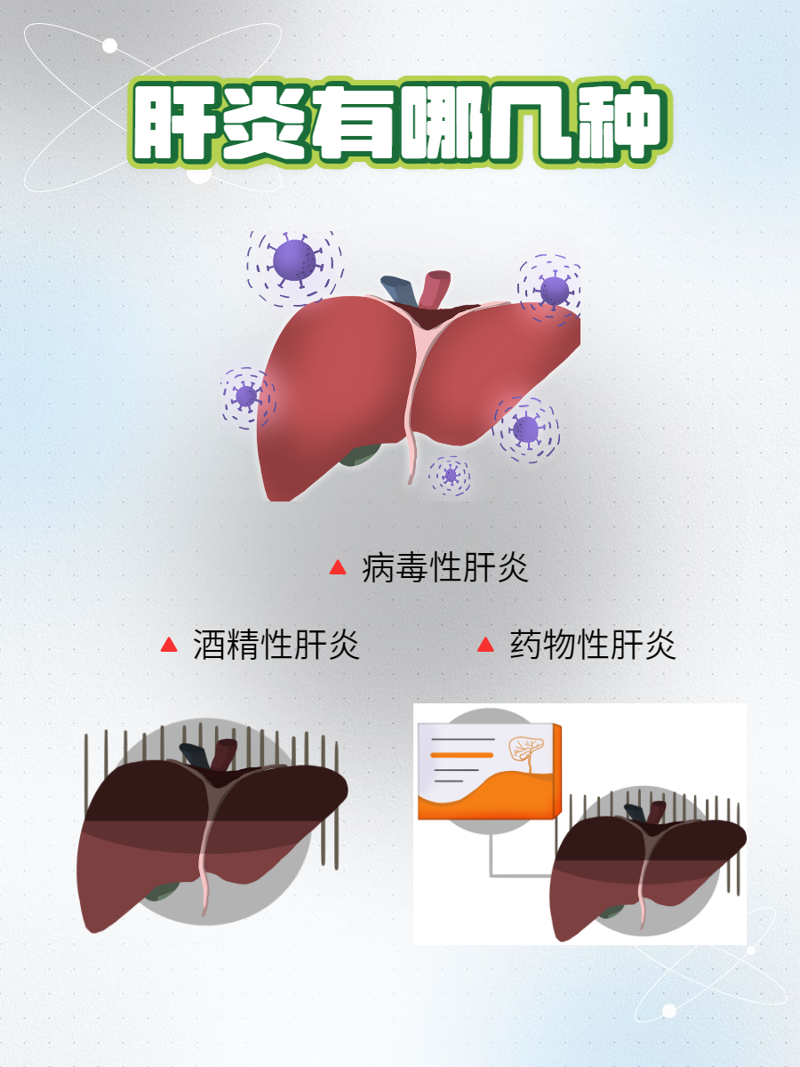 分类详解  肝炎是一类由多种原因引起的肝脏炎症性疾病,了解不同类型