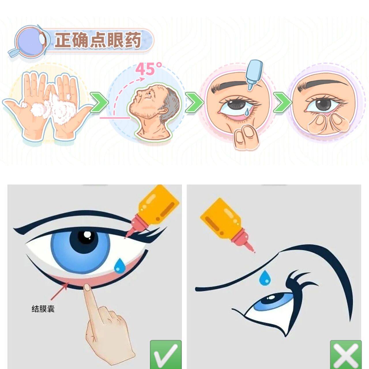 正确的滴眼药水方法7515 手机电脑党,难以入眠熬夜党,眼干眼涩眼