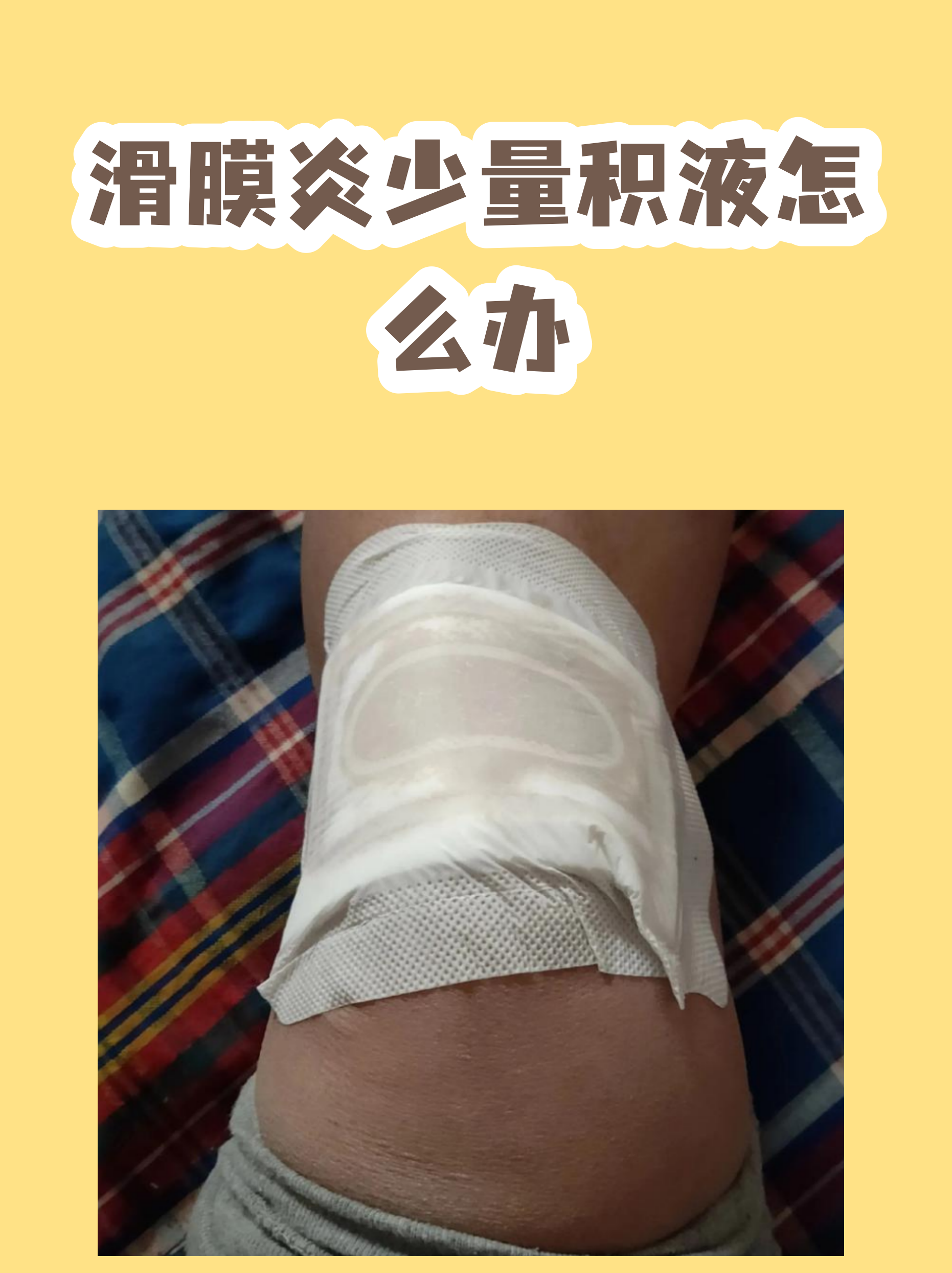 宣武医院代诊挂号服务流程-缓解就医焦虑的简单介绍 宣武医院代诊挂号服务流程-缓解就医焦虑的简单介绍