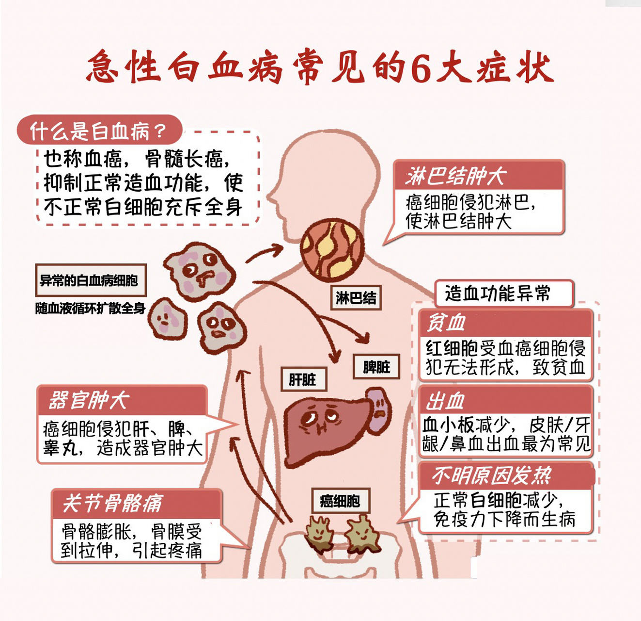科普19 | 容易忽视的白血病早期6大症状 !