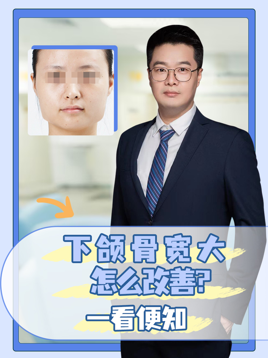 下颌骨宽大怎么改善?