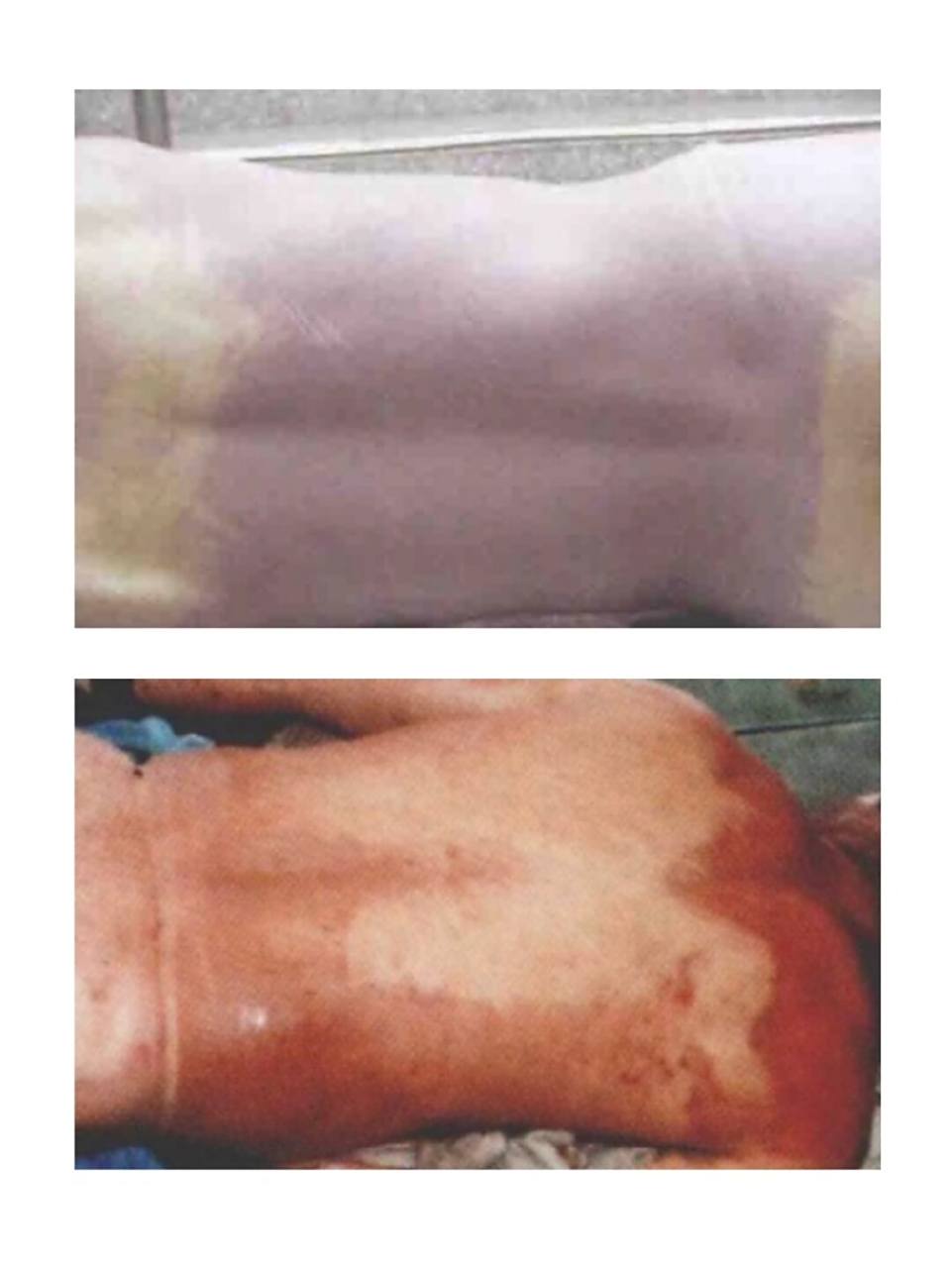 喜欢尸斑画法?