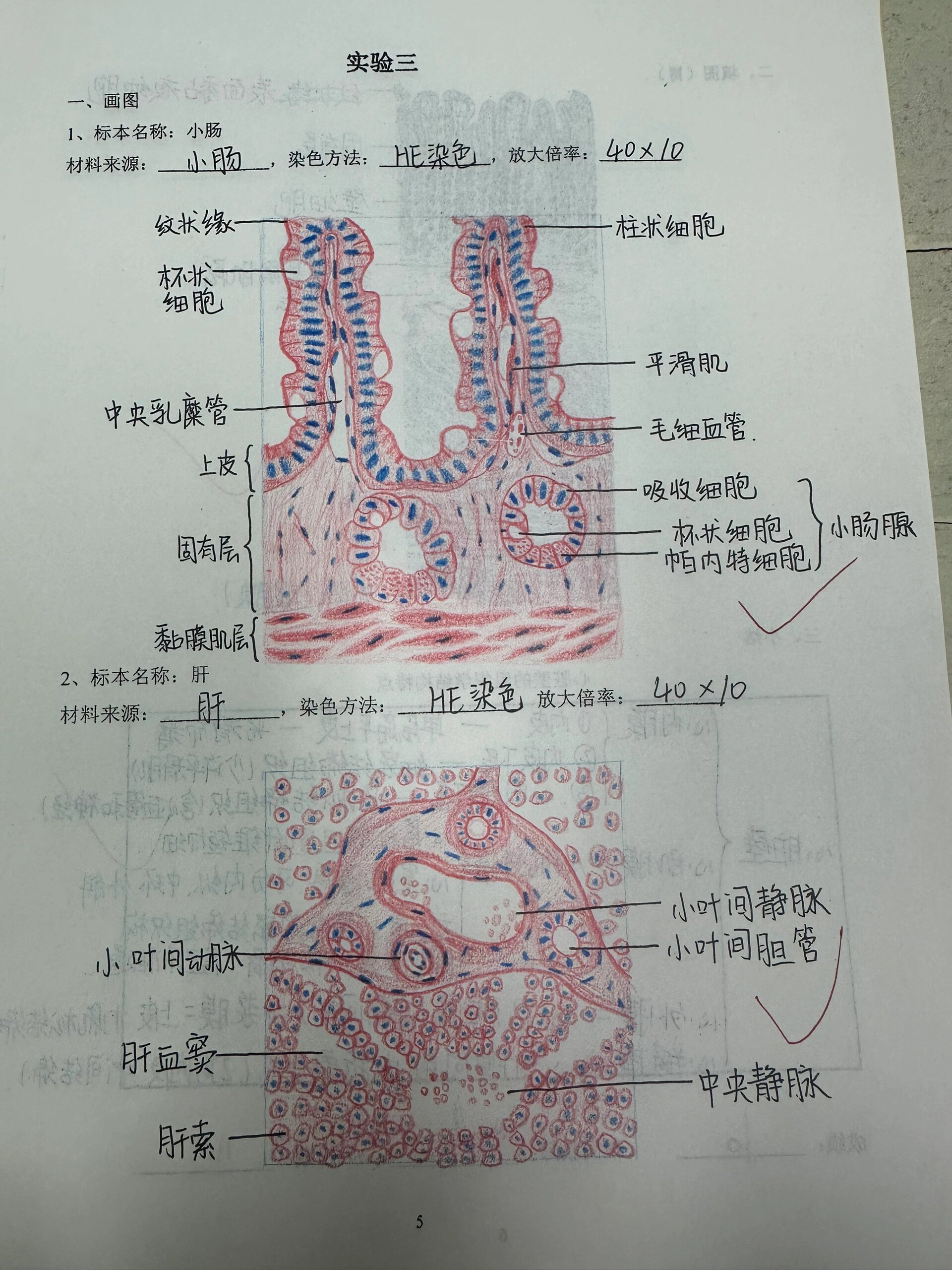 葡萄胎红蓝铅笔图图片