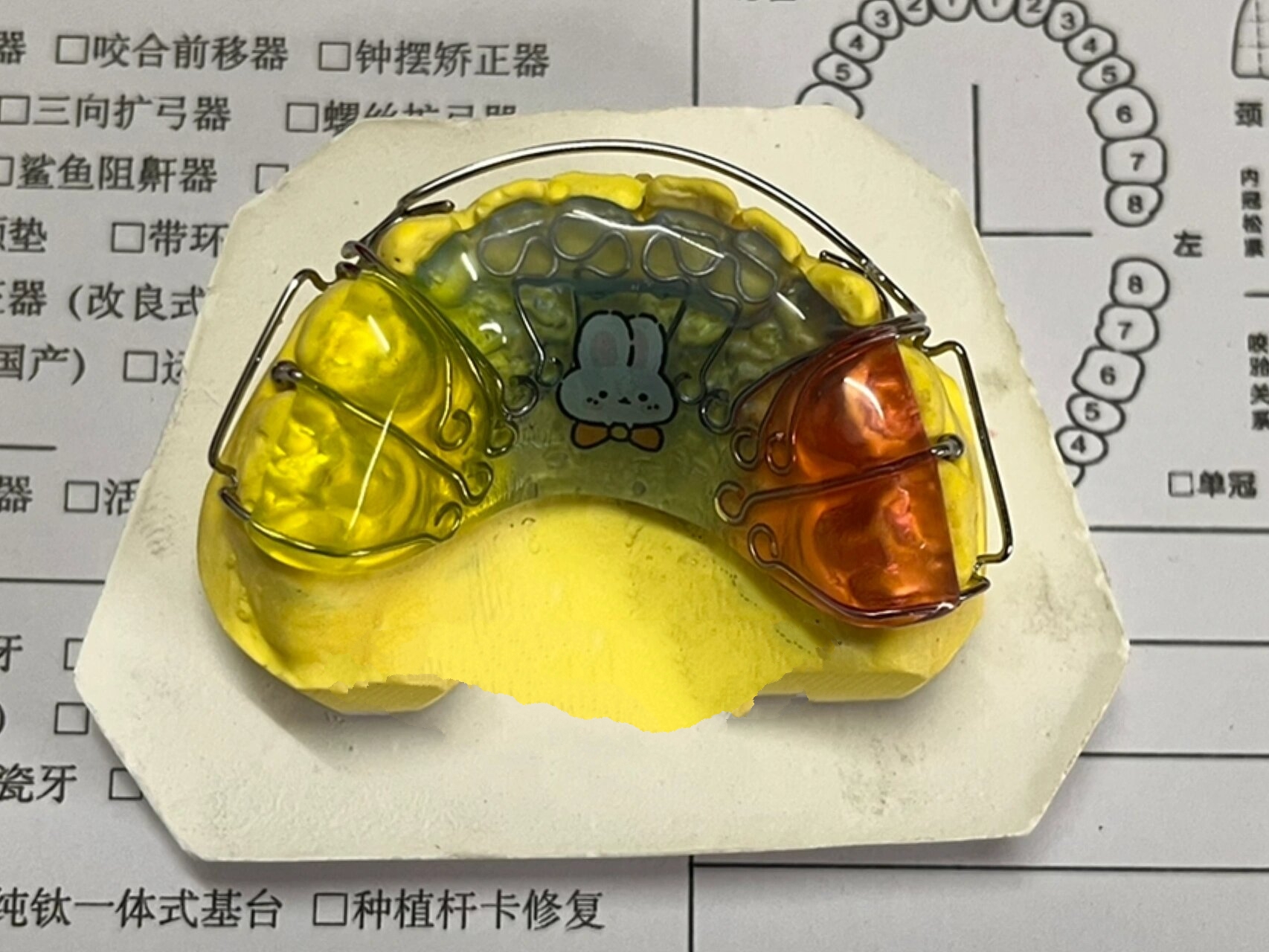 —反颌颌垫推簧矫治器❗️