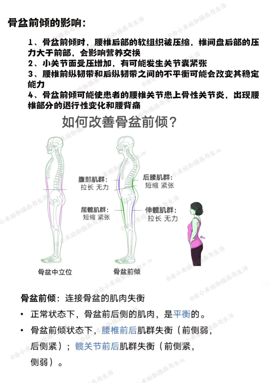 体态|骨盆前倾自我检测 改善动作 看到一句话"无评估不训练,无纠正不