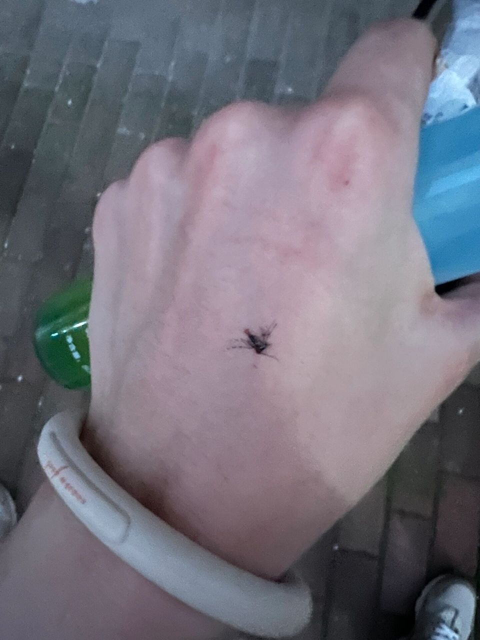 蚊子 多讽刺,我手带驱蚊手环,手拿花露水,依旧被蚊子咬了,但是我还是