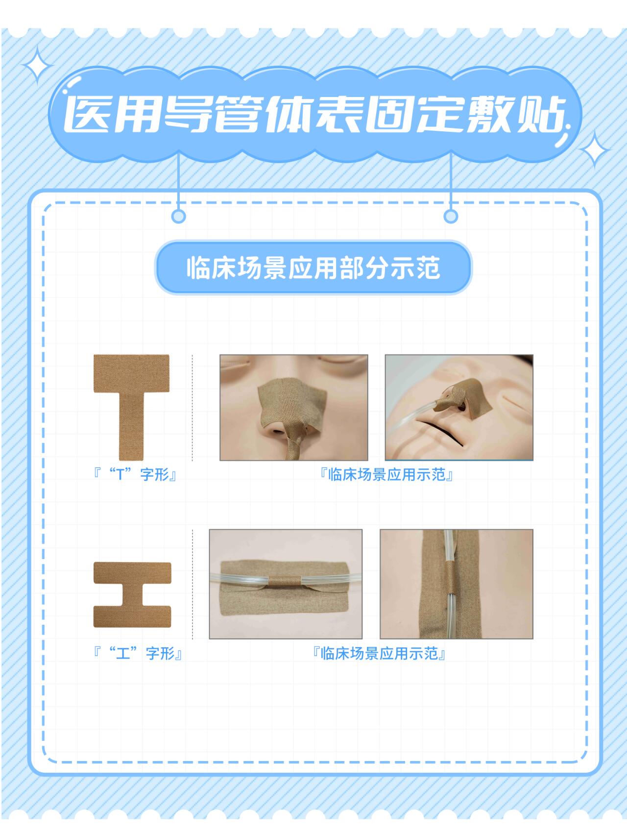 医用导管体表固定敷贴的形状大合集来啦