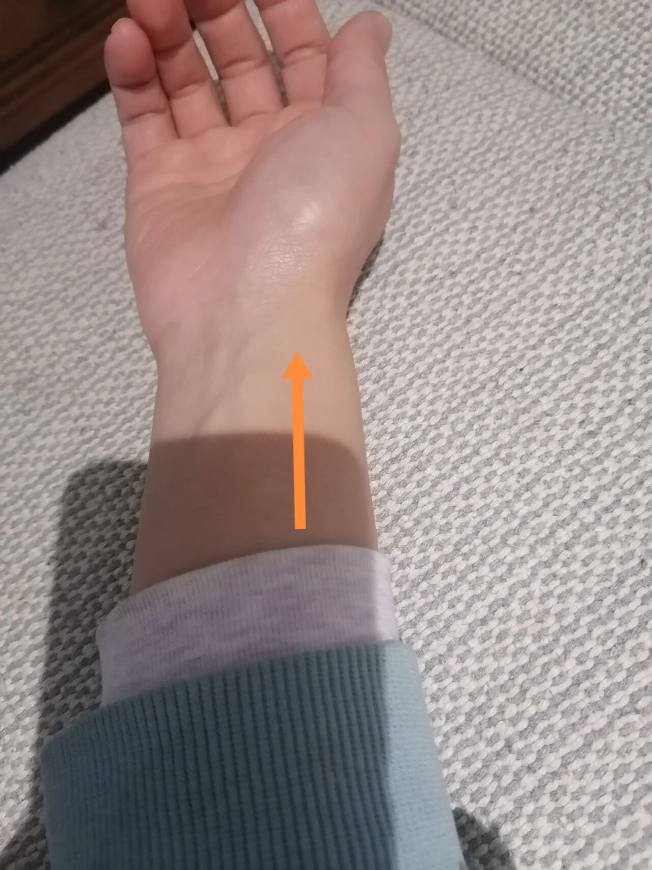 手腕筋疼 手腕拧毛巾时剪头那一道筋肉就疼,有没有和我一样的姐妹