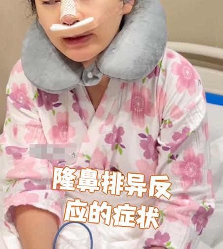 隆鼻手术后如果出现排异反应,患者通常会有这些