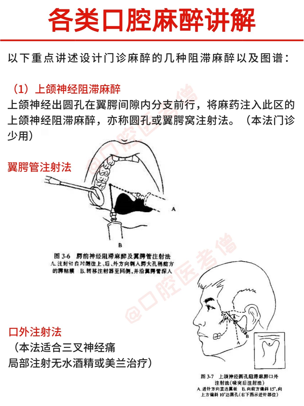 龈下刮治麻醉注射点图片