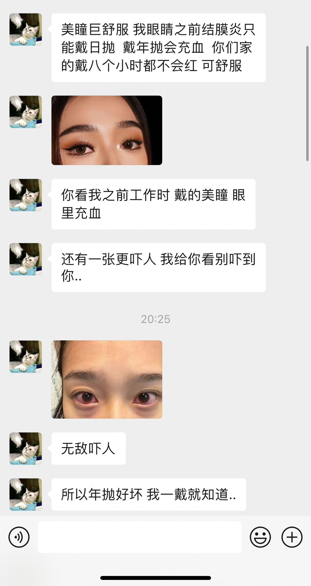 戴美瞳眼睛发炎成这样?尊嘟假嘟! 真的救命啊 眼睛红成那样!