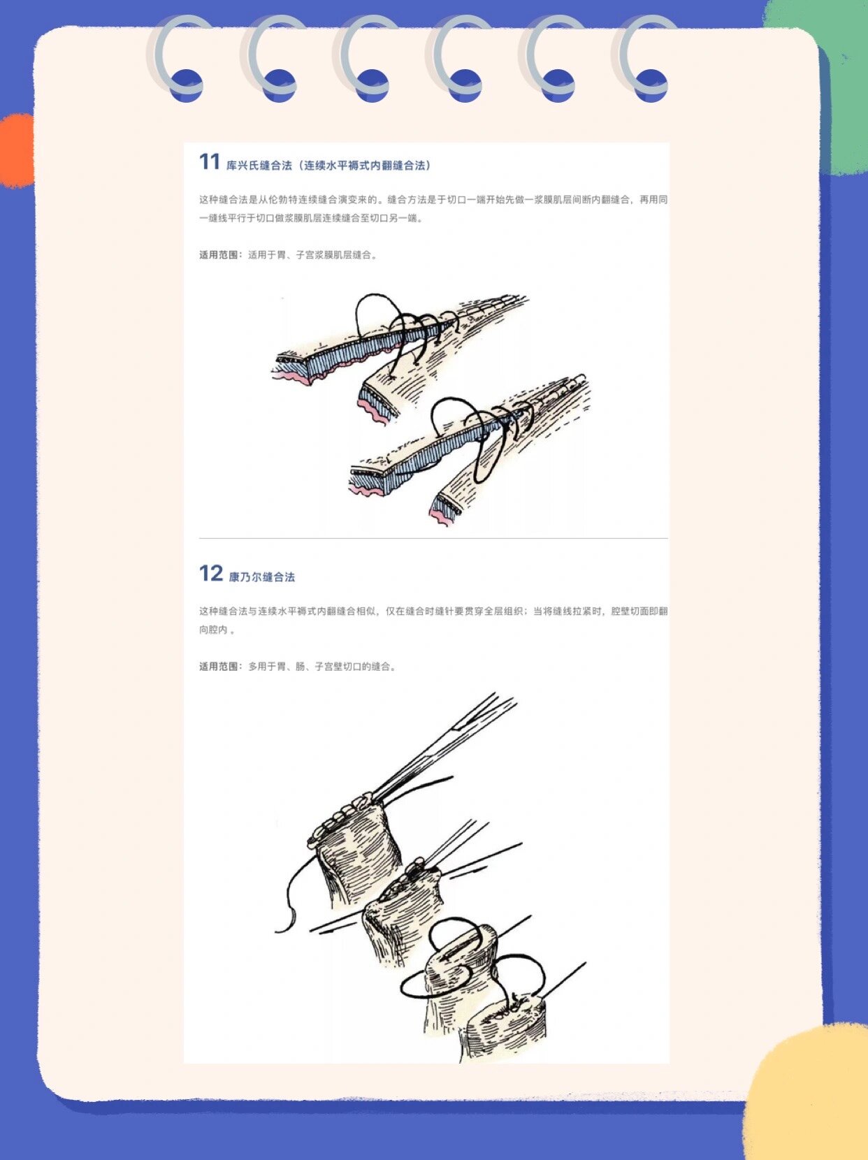 13种外科缝合方法 1 单纯间断缝合(结节缝合) 适用范围:结节缝合