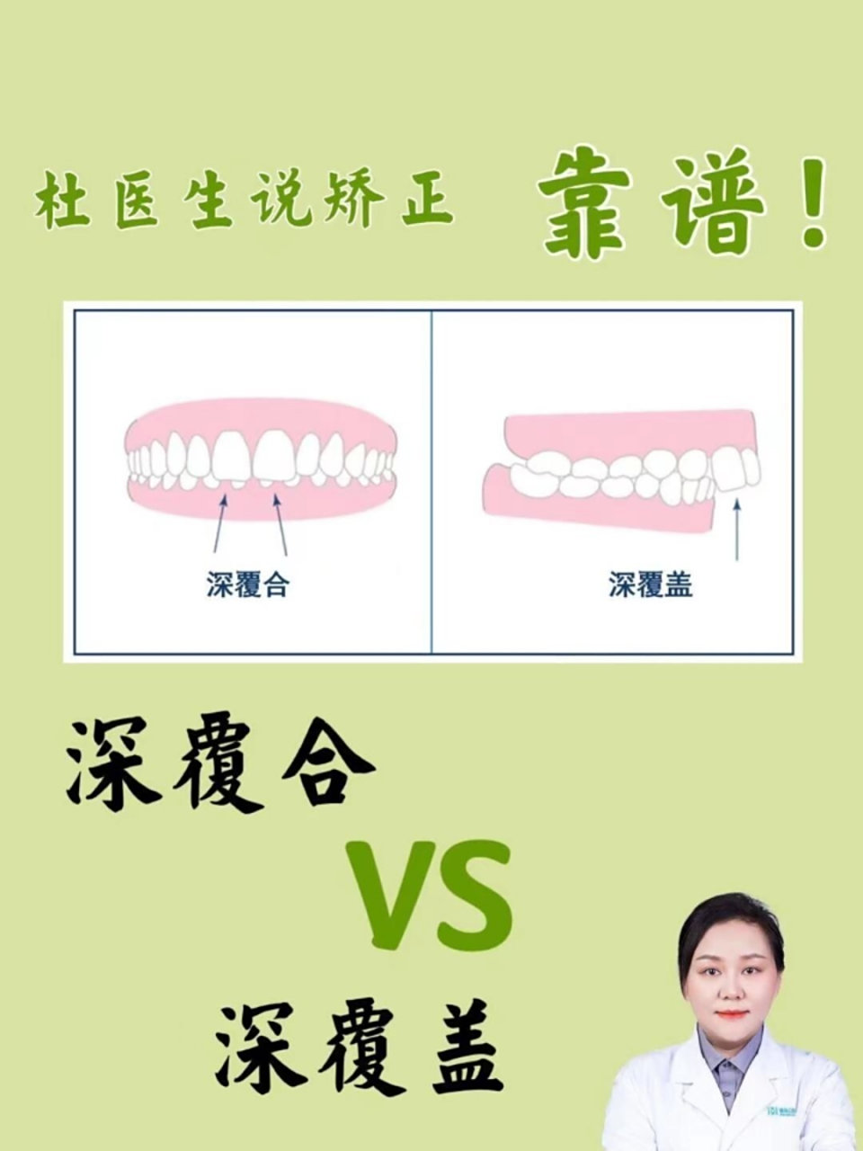 深覆合vs深覆盖,看完这一篇都明白了7515 经常有人来问我:"04我