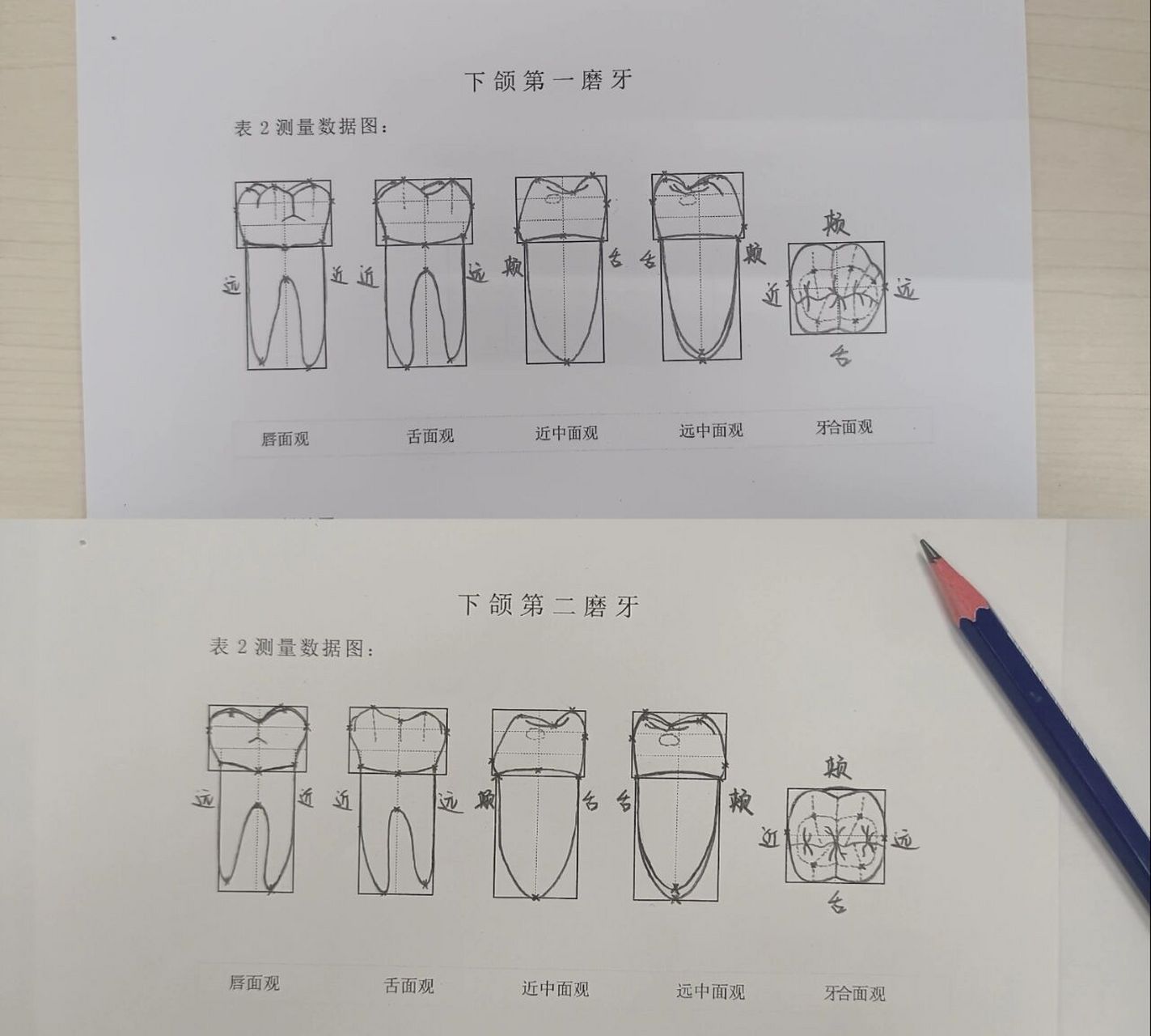 牙体外形绘图③