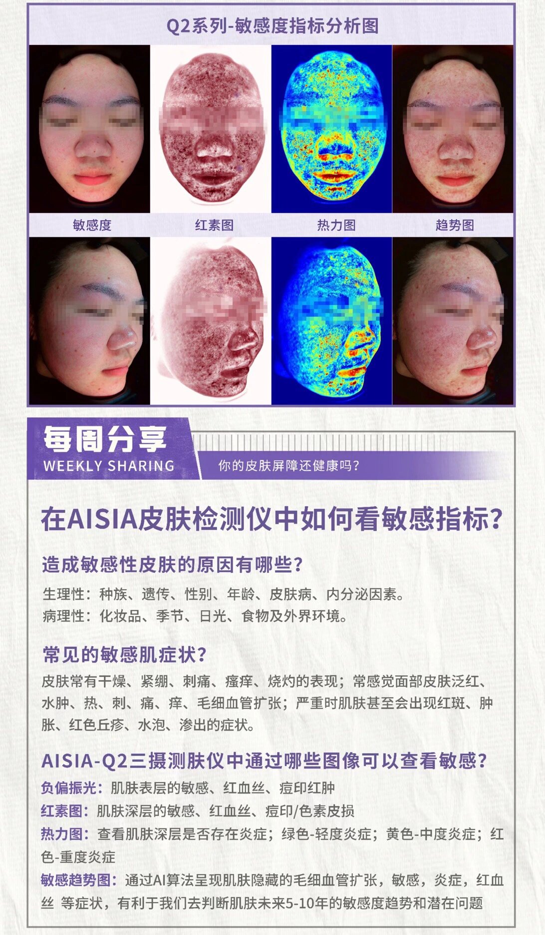 aisia皮肤检测仪