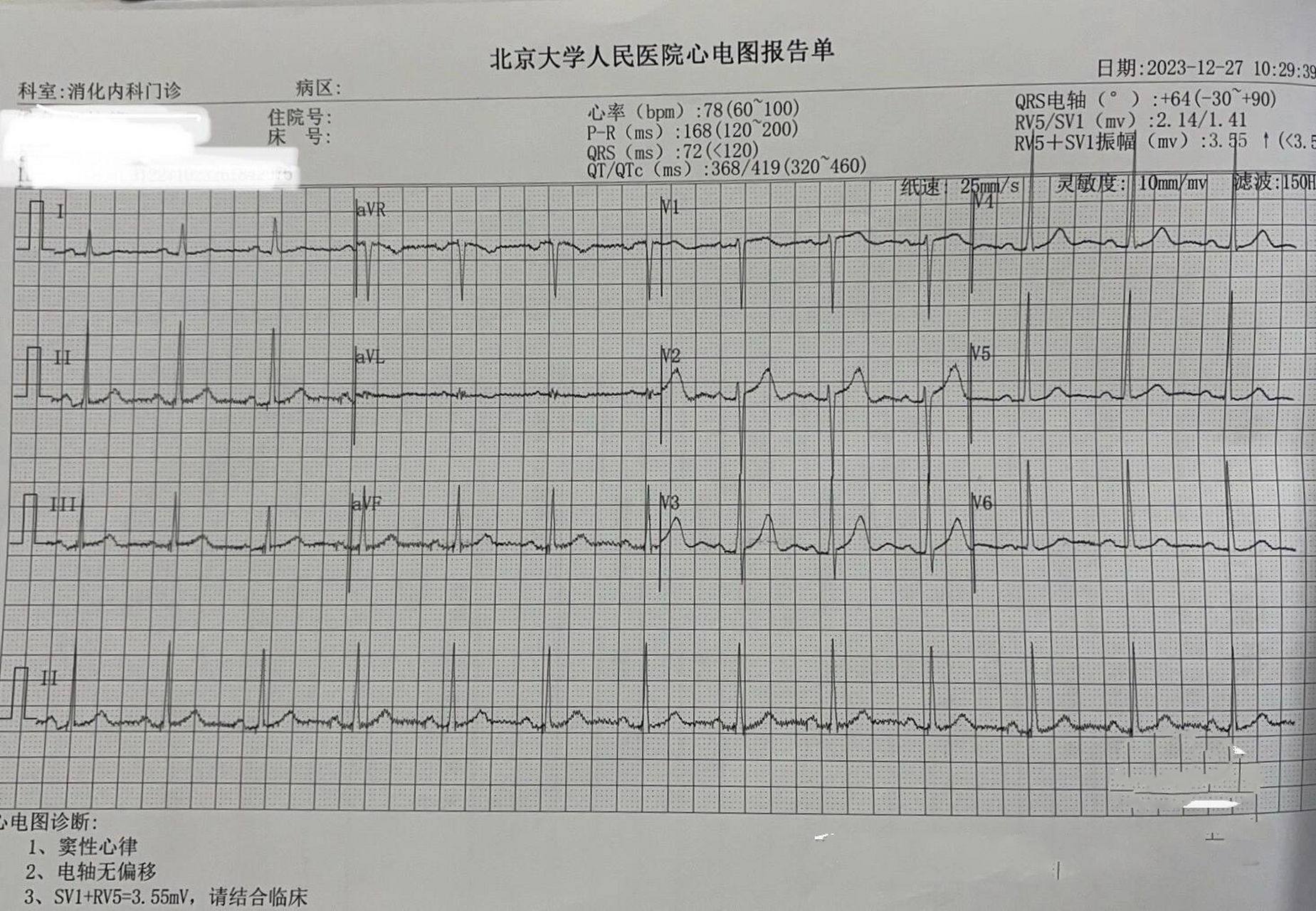 没想到有一天心电图也会出问题  本来想做无痛胃肠镜,一查居然心电图