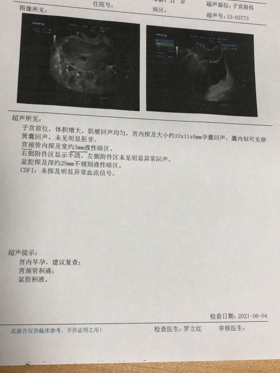 怀孕35天去医院做的阴超,医生开的补孕酮和保胎药,我吃了后小腿酸胀