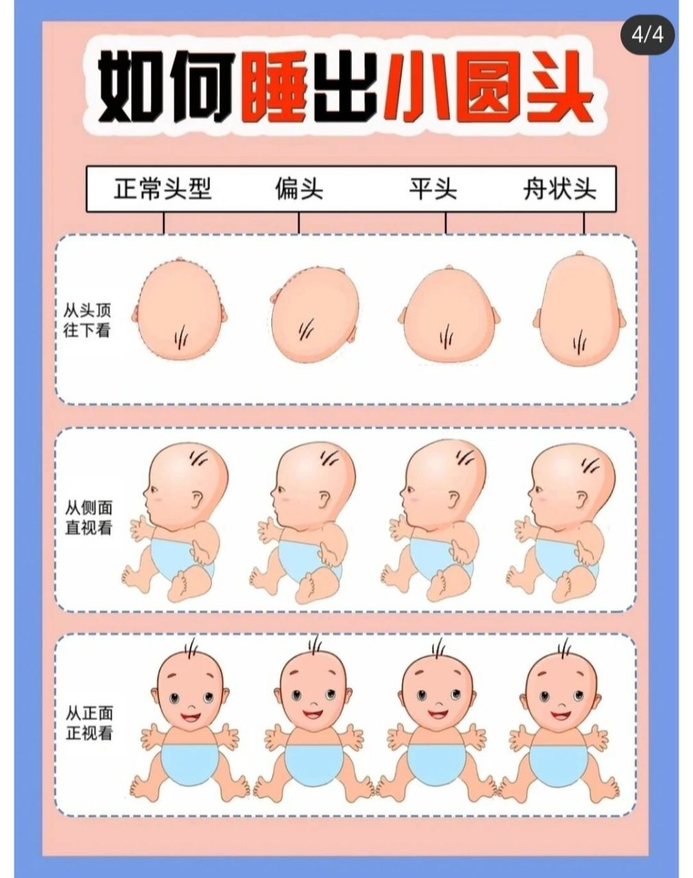 出生不久的宝宝头骨是比较软的,平时因为一 些不好的睡姿或是妈妈的