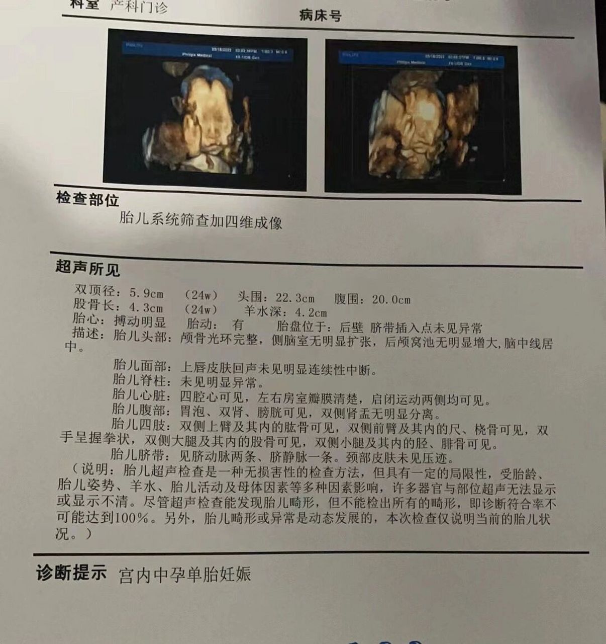 四维看男女 有没有亲能看出是男还是女孩