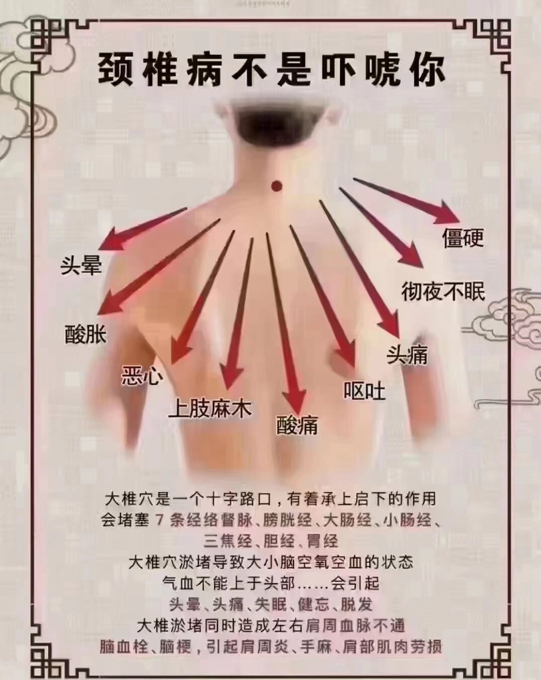 我们后脖子上有风府,风池,风门这三大穴位!