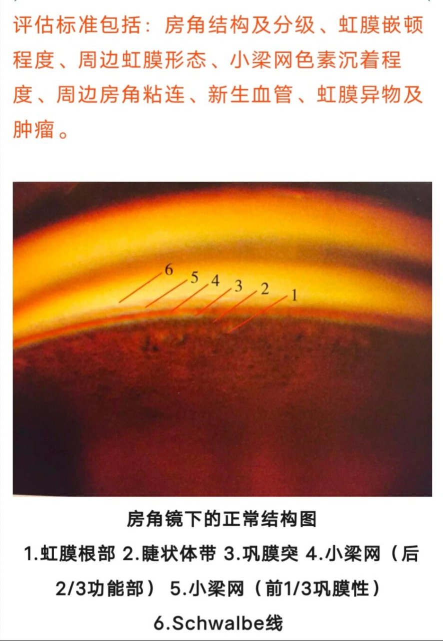 眼科小谢学习小tips 明天我们组老师中午带我们看房角镜 	 所以今天