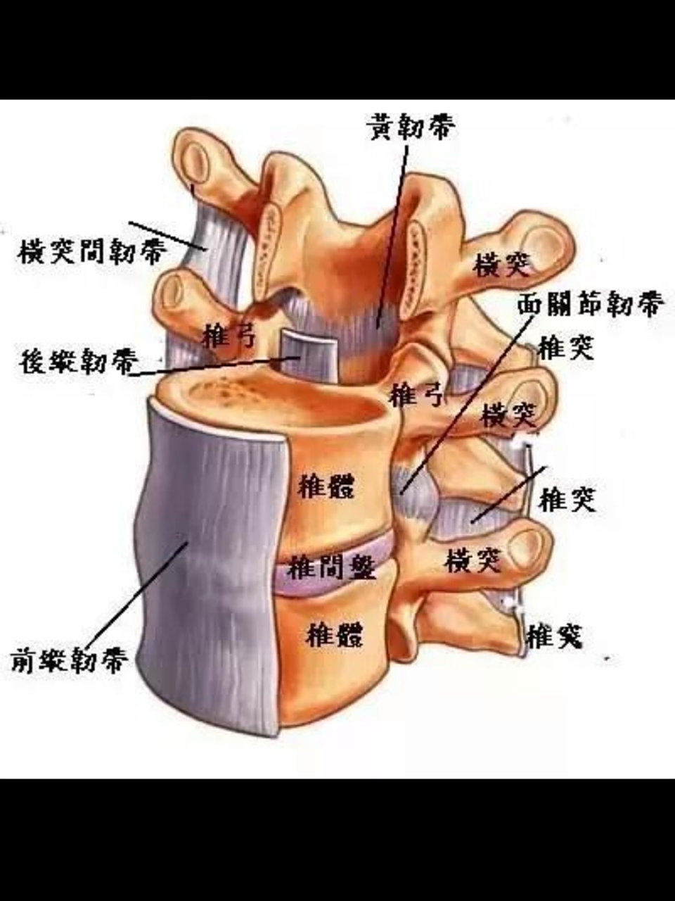 记录腰间盘突出椎间孔镜术后66天 得了腰突以后,半
