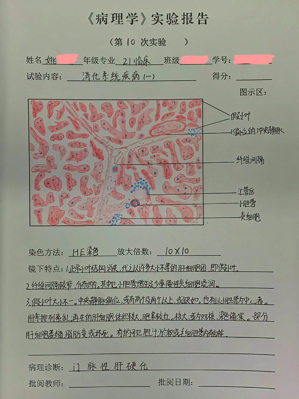 肝硬化手绘图实验报告图片