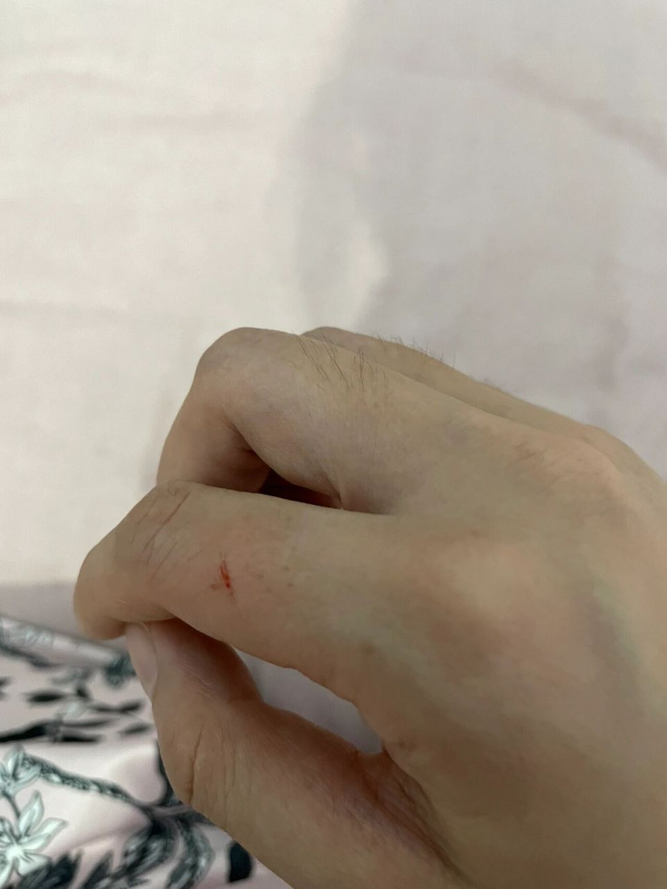 被自家狗狗指甲划伤流血,需要打疫苗么 有知道的么?