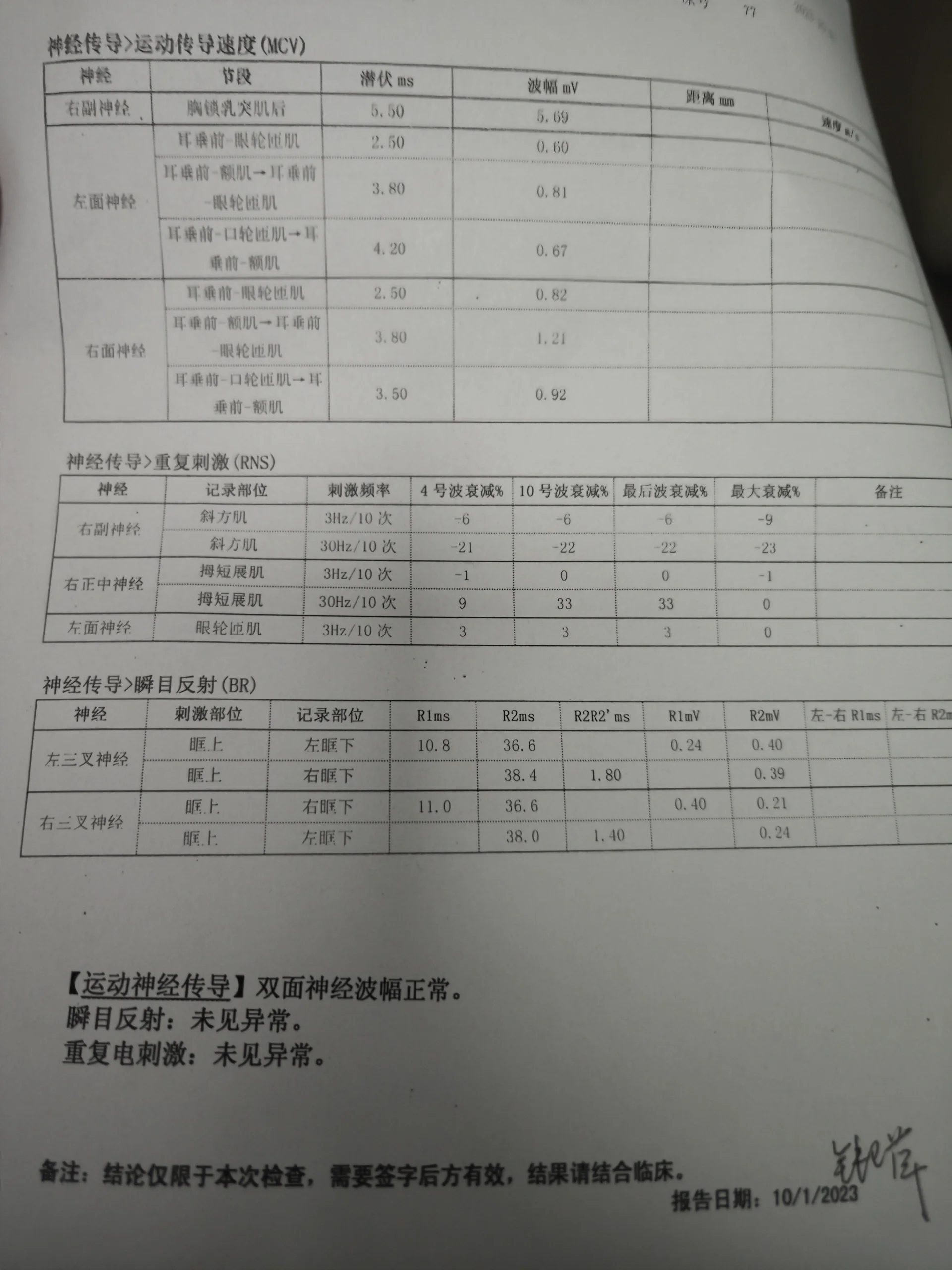 肌电图检查多少钱图片