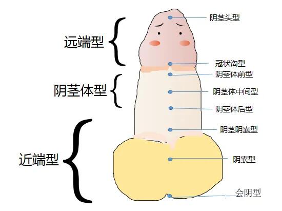 女宝宝尿道下裂图片