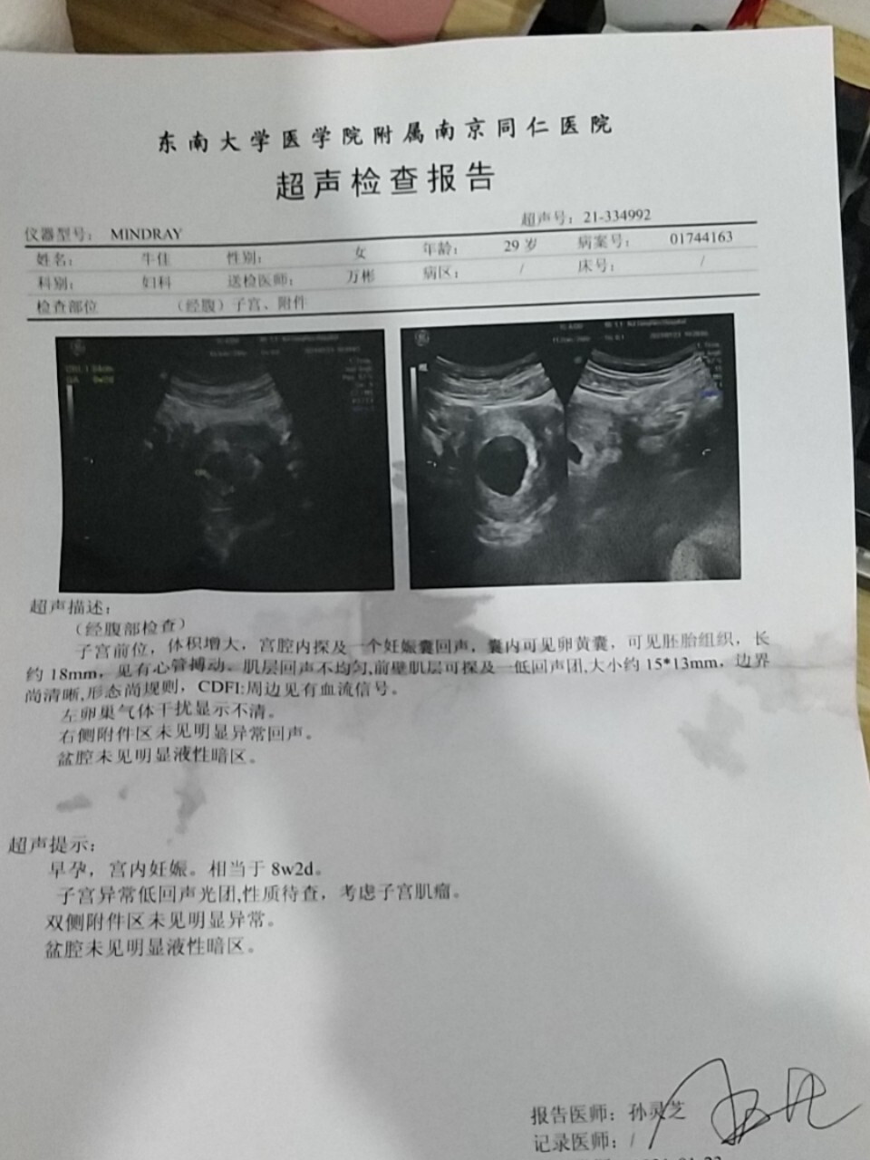 十周的b超出来啦,玻璃心母亲每周一查 年初有过次胎停史,这次怀孕从