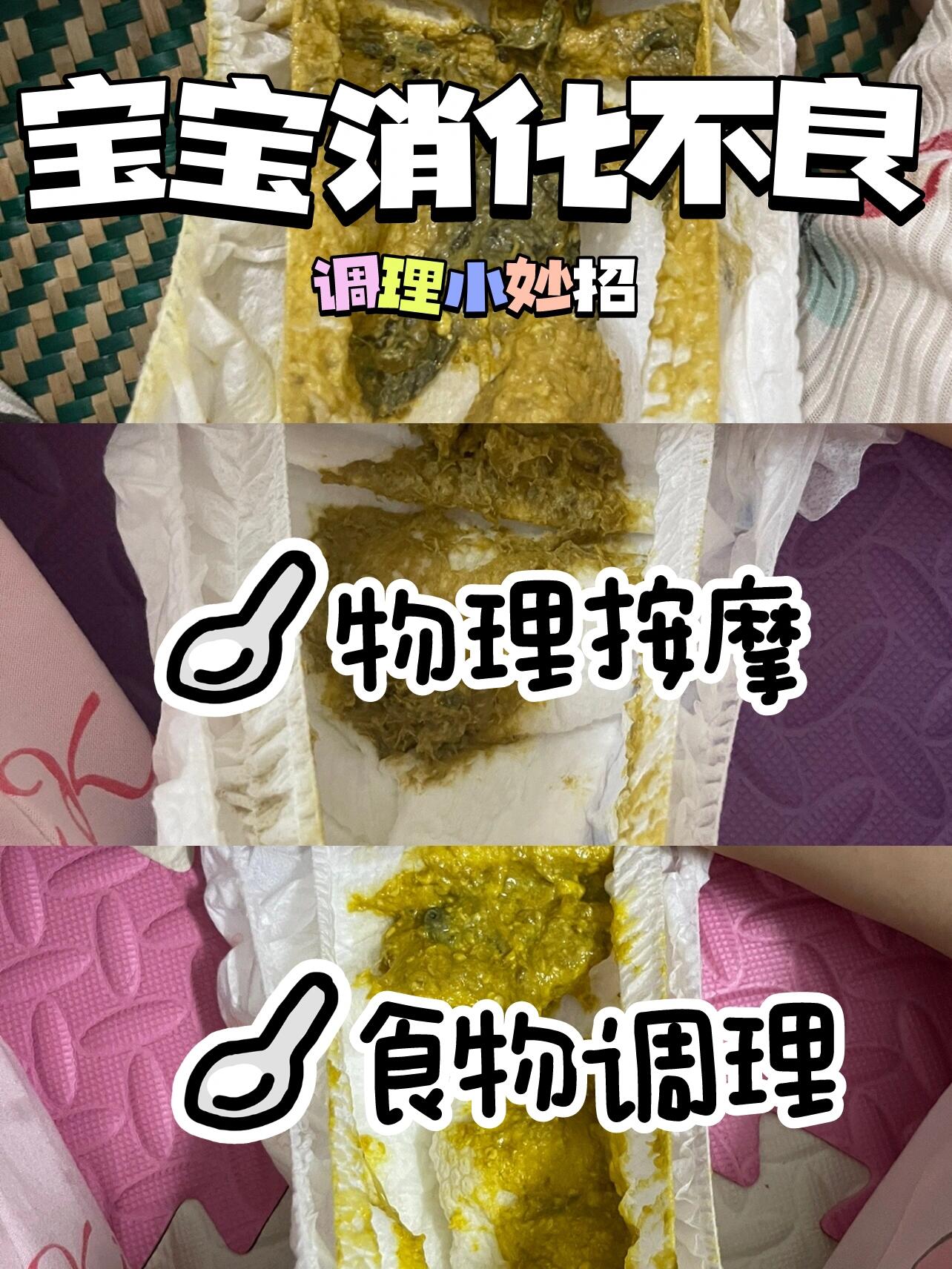 7415母乳喂养出现消化不良情况很少很少很少!