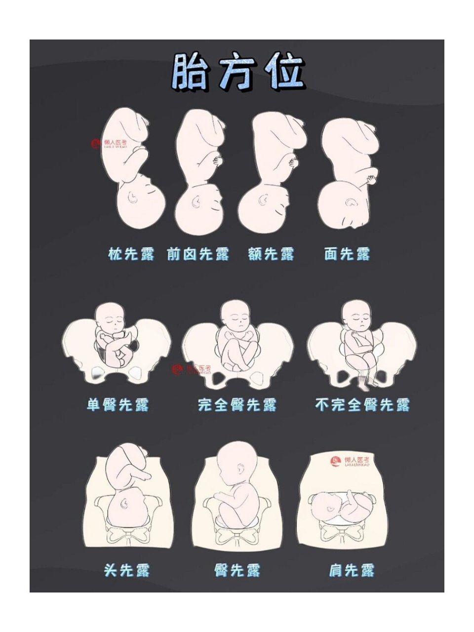 胎儿先露部的指示点与母体骨盆的关系称胎方位,简称胎位.