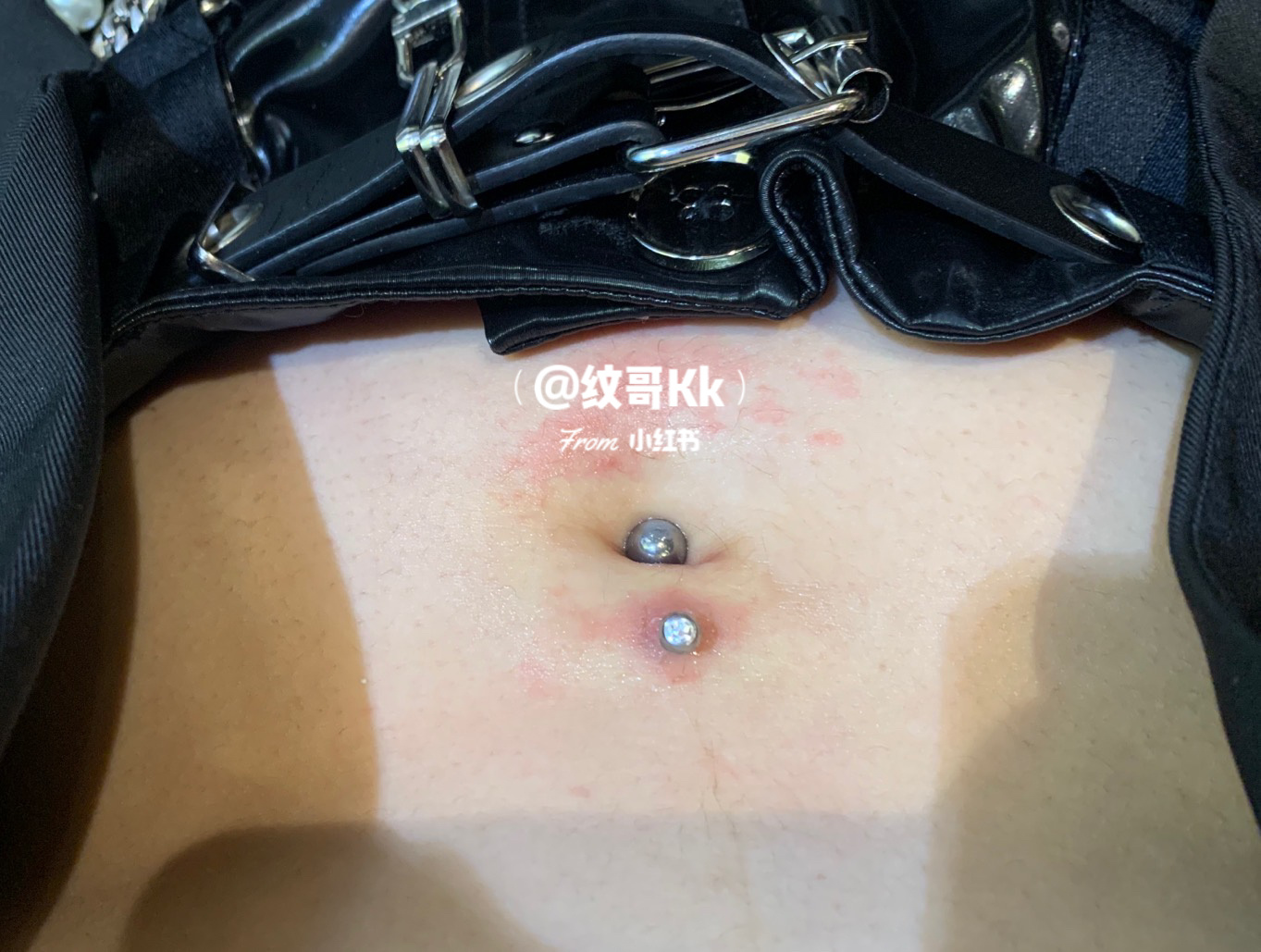 疤痕体质的肚脐钉恢复经验|亲测 关于肚脐钉的恢复过程我真的是太有