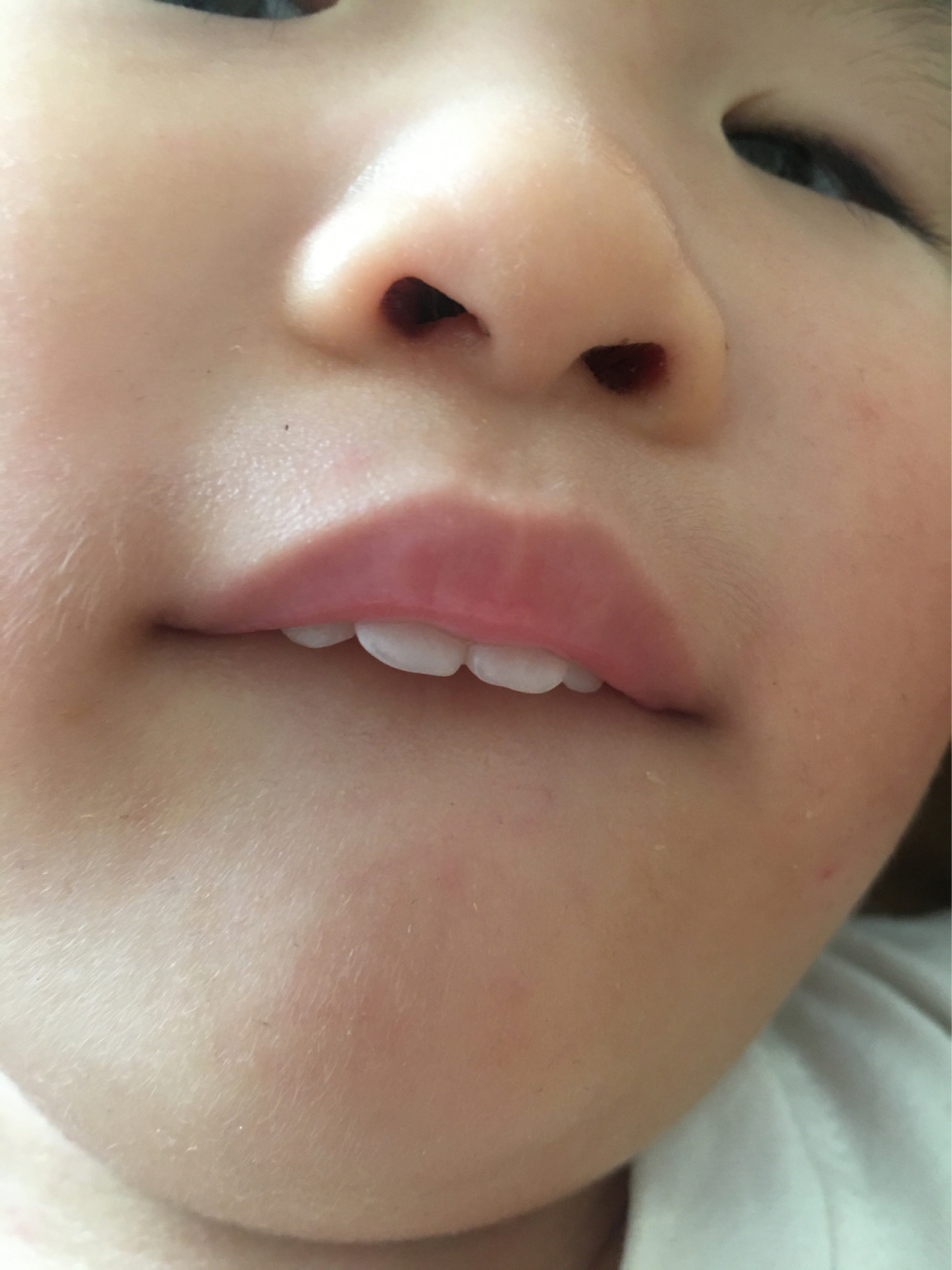 宝宝咬下嘴唇一定要趁早断了01 这个以后只能矫正了不知道这样子的