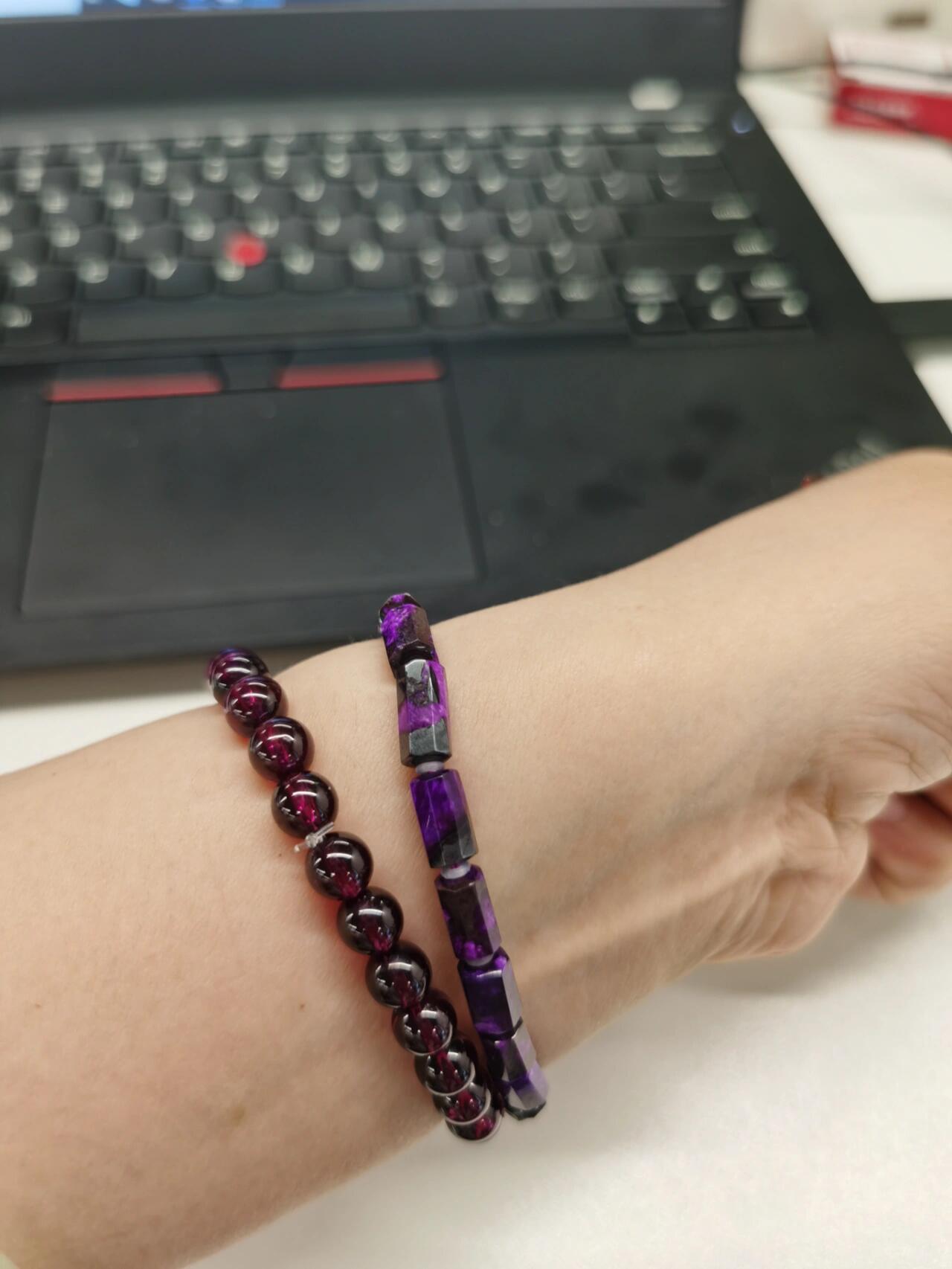 我的舒俱来掉皮啦 真的,短短两周 我的舒俱来黑皮掉了好多 颜色越来越