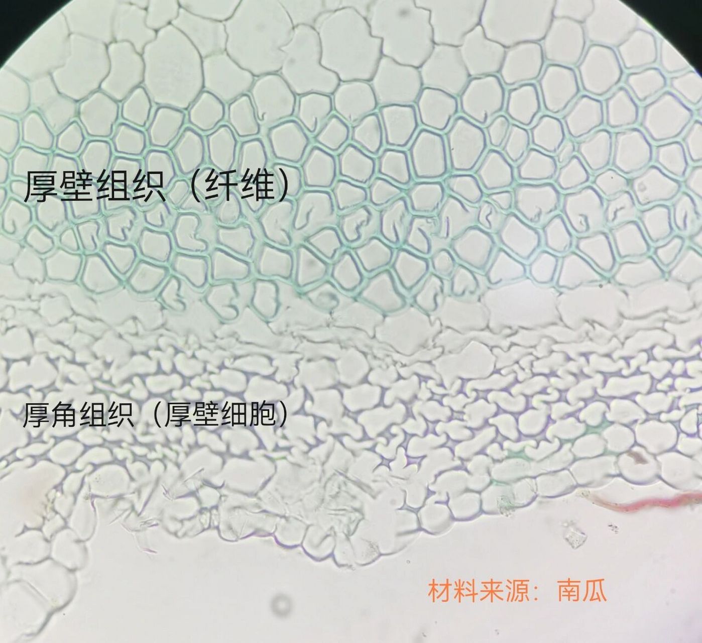 厚壁组织简图图片