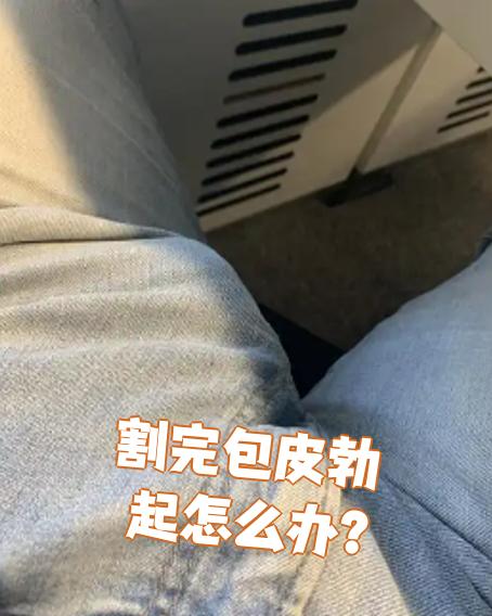 男生为什么要割包皮图片为什么在线