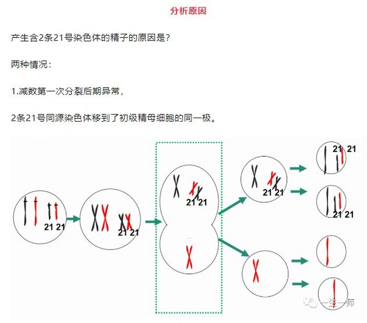 21三体综合征 染色体图片