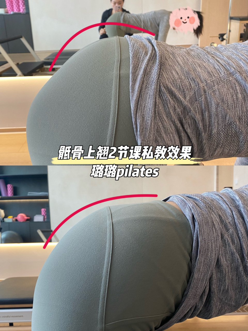 快速改善骶骨上翘    普拉提强调核心稳定和控制,骨骼的正确排列.