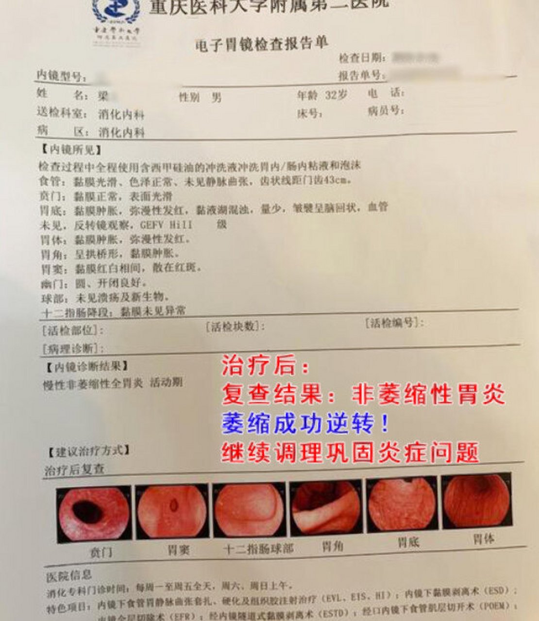 胃病化验单图片