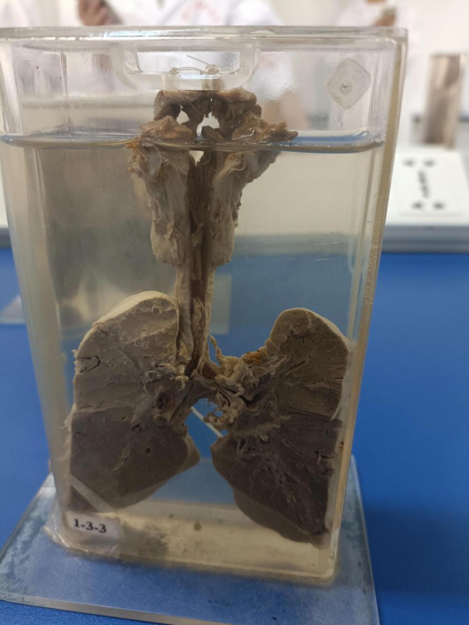 病理生理学大体标本学习 局部血液循环障碍 图1.