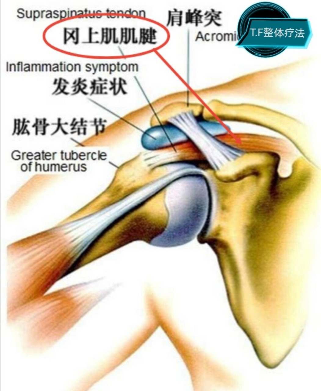 肩冈上肌的位置图片图片