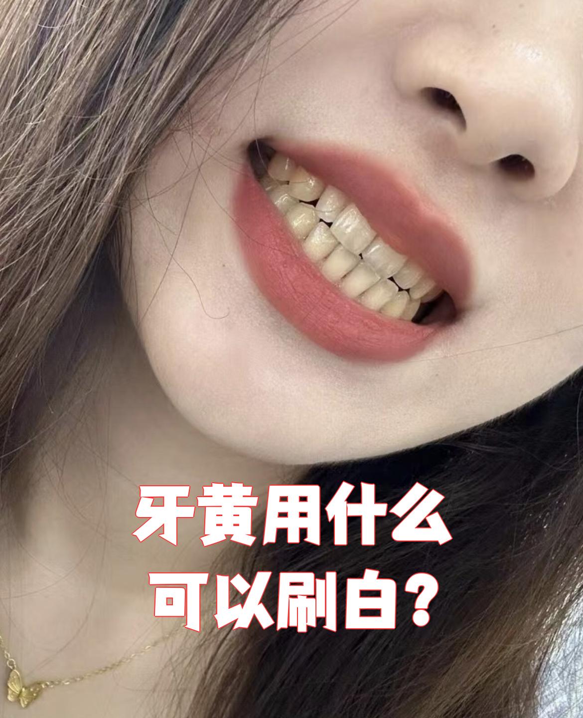 牙齿发黄什么原因百科在线 牙齿发黄什么原因百科在线