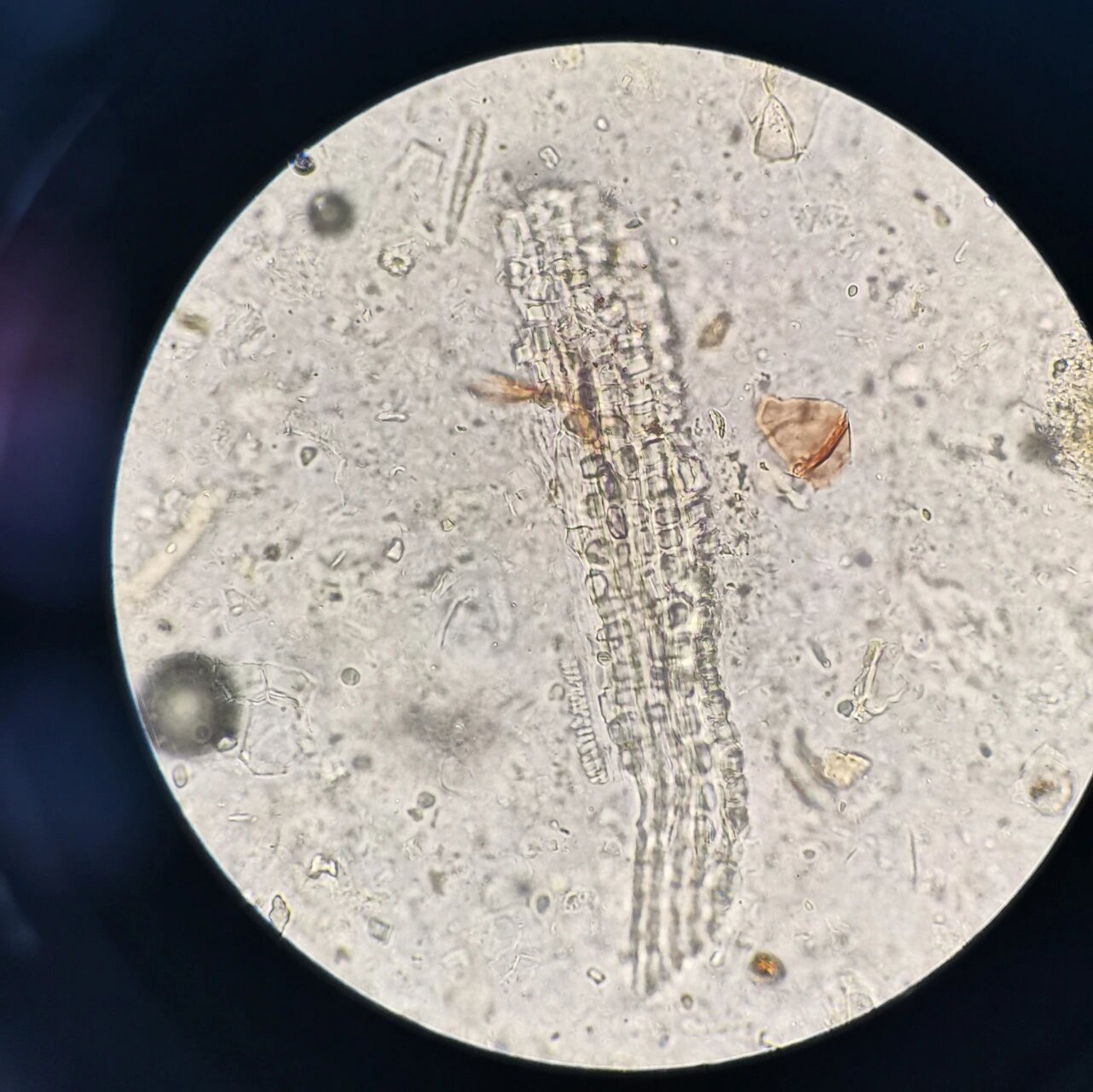 1,晶纤维多,草酸钙方晶. 2,非腺毛单细胞,壁厚,有疣状突起.