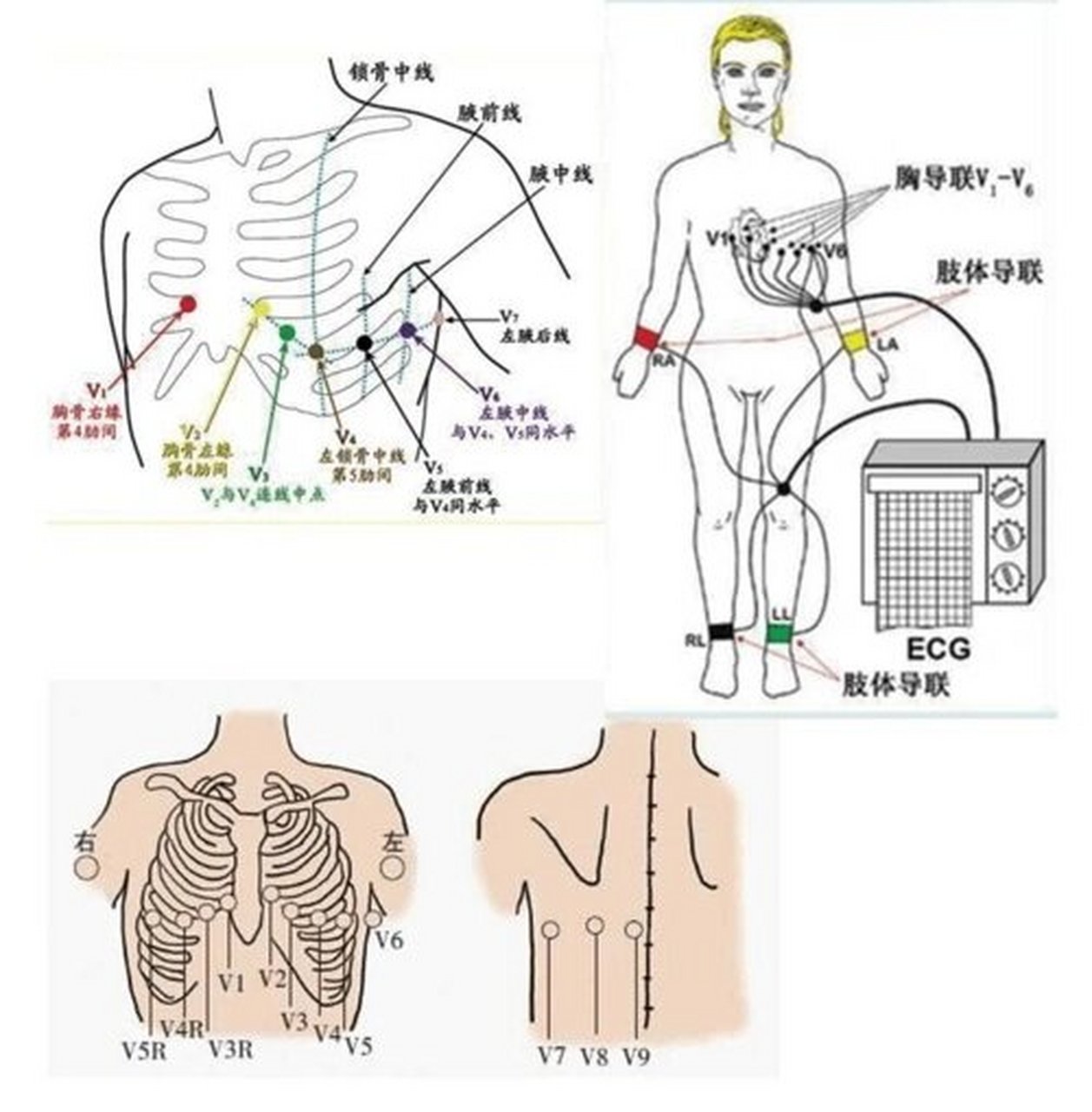 心电图十二导联位置图