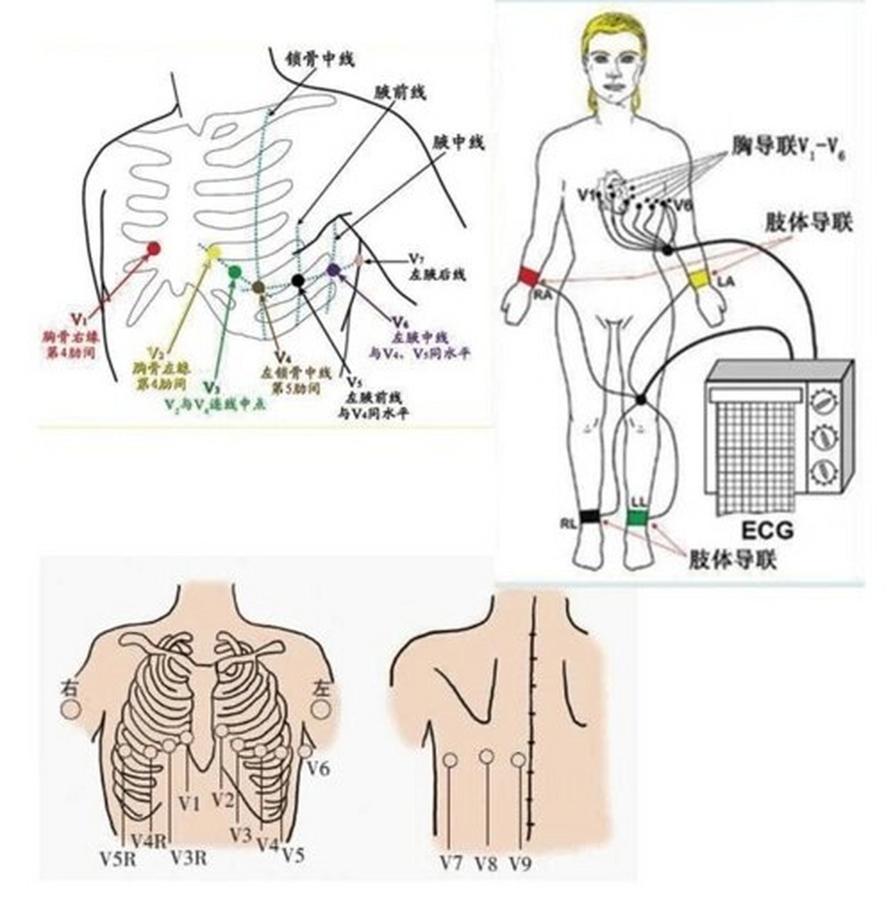 胸导联v1到v6的位置图片