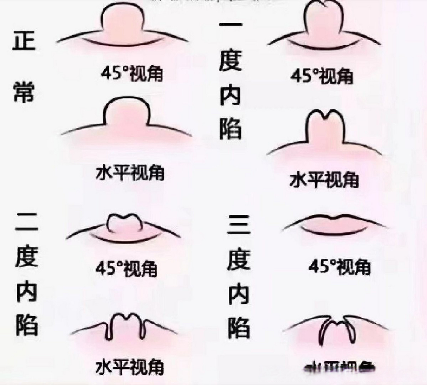 乳头正常真实有多大图片