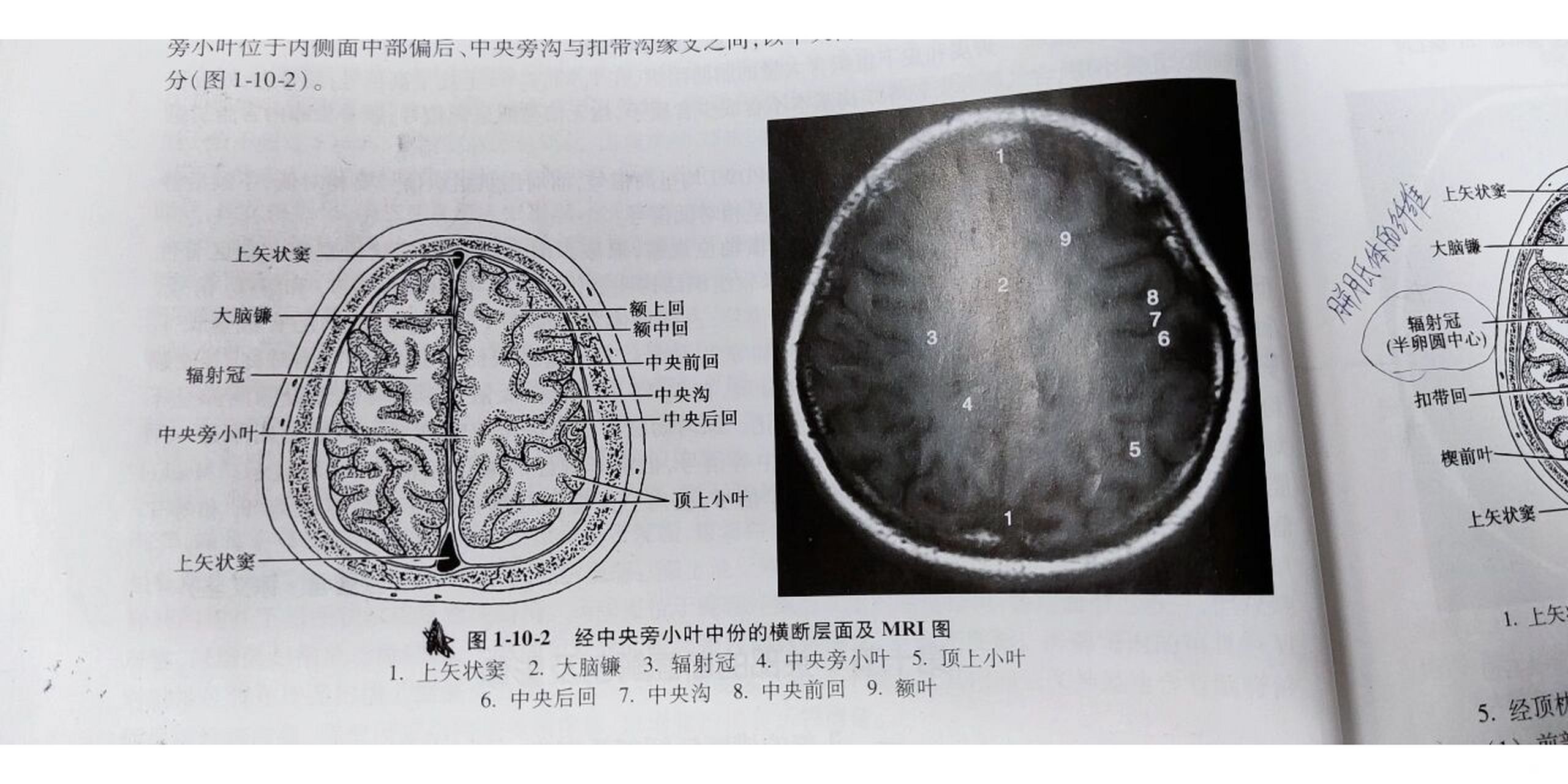 中央旁小叶解剖图图片